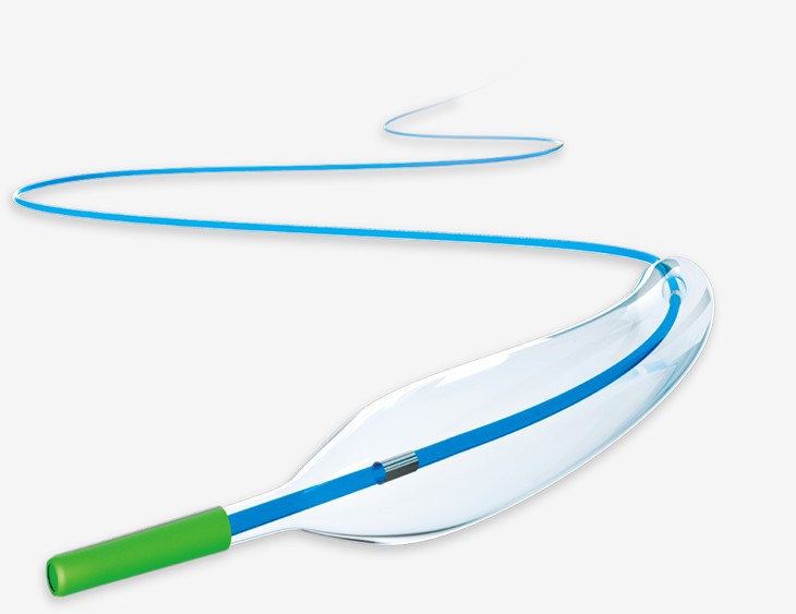 قسطرة توسع الشريان التاجي